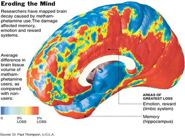 메스암페타민(필로폰) 투약으로 일어나는 뇌 손상. 파란 색은 손상되지 않은 부분, 붉은 색은 손상된 부분을 보여준다. 특히 감정(emotion)과 보상(reward), 기억(memory)를 담당하는 부분이 가장 크게 손상된다.