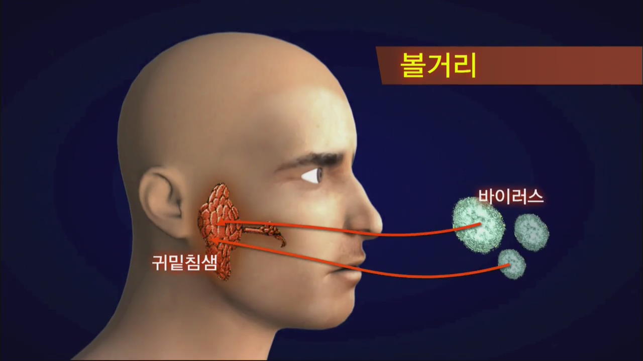http://mn.kbs.co.kr/news/view.do?ncd=2712920 볼거리 유행, 집단감염 우려 > 일요뉴스타임 > 라이프 > 뉴스 | KBSNEWS