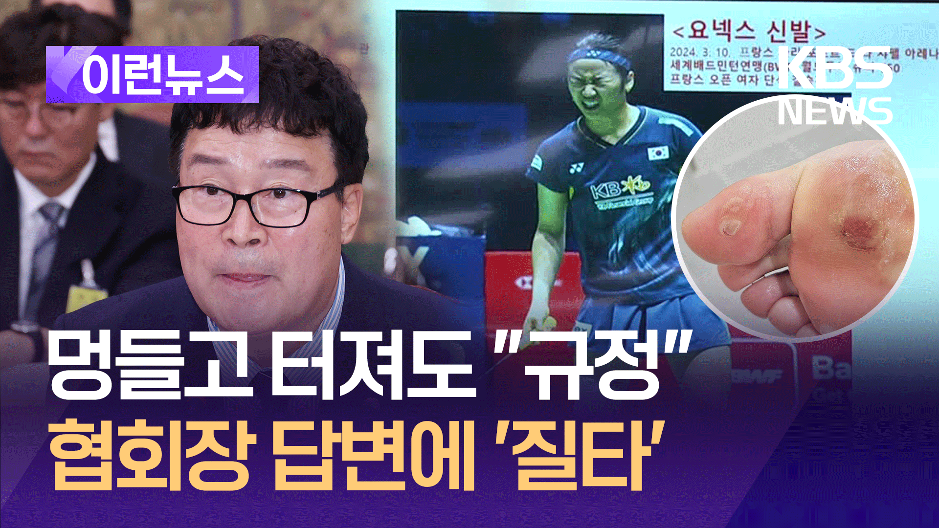 ‘발바닥 물집’ 안세영 신발 안 바꿔준 이유 묻자…협회장 “어쩔 수 없는 규정”