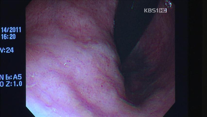 최동원 사인 ‘대장암’, 10년새 2배 증가