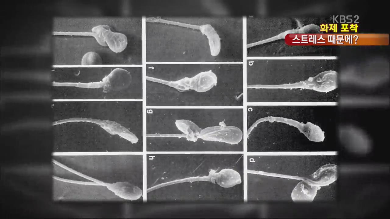 [화제포착] 30~40대 남성 불임 급증, 원인은?