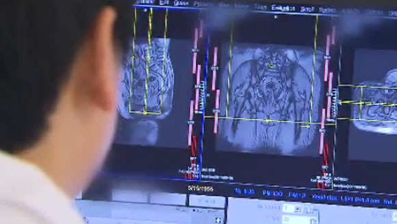 [취재후] CT·MRI 촬영하다 사망? 무서운 ‘조영제’ 부작용