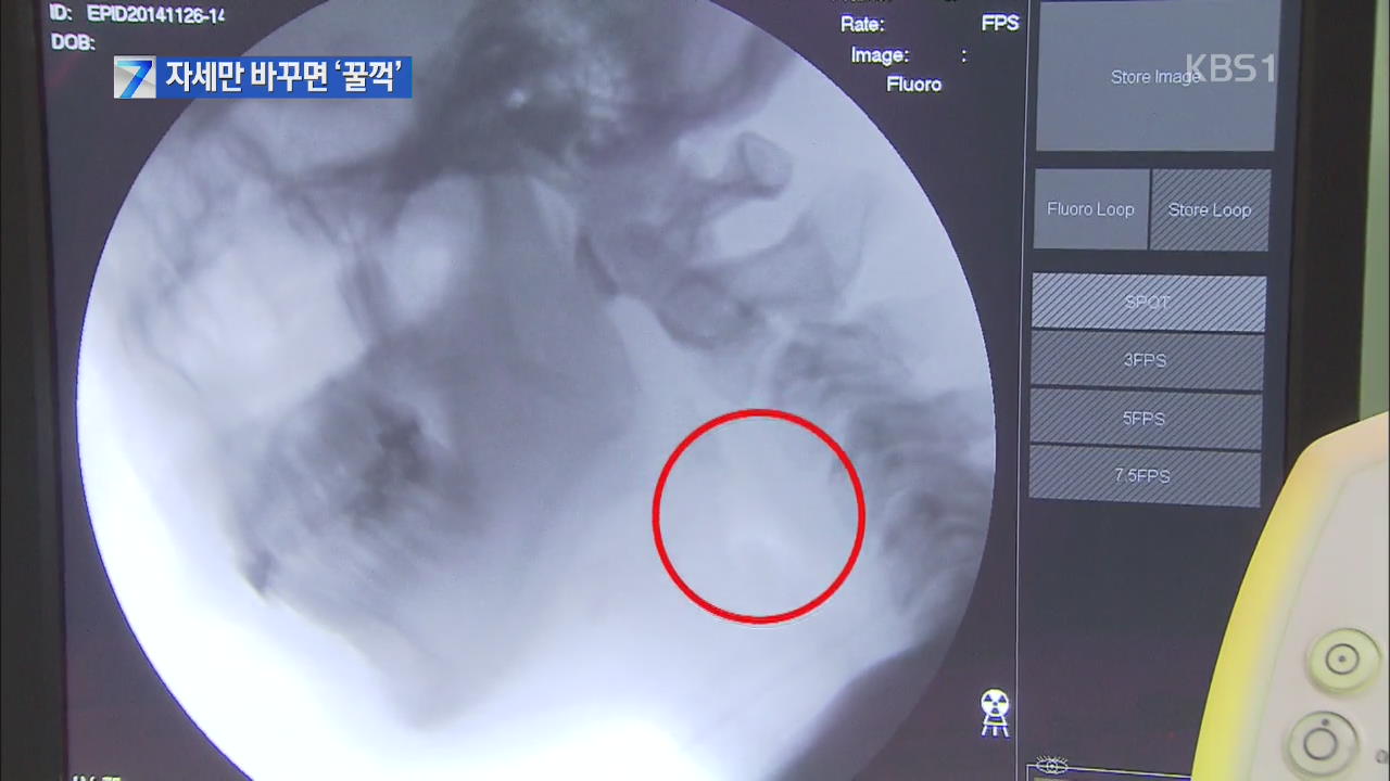 삼키기 어려운 알약, 자세만 바꾸면 한번에 ‘꿀꺽’