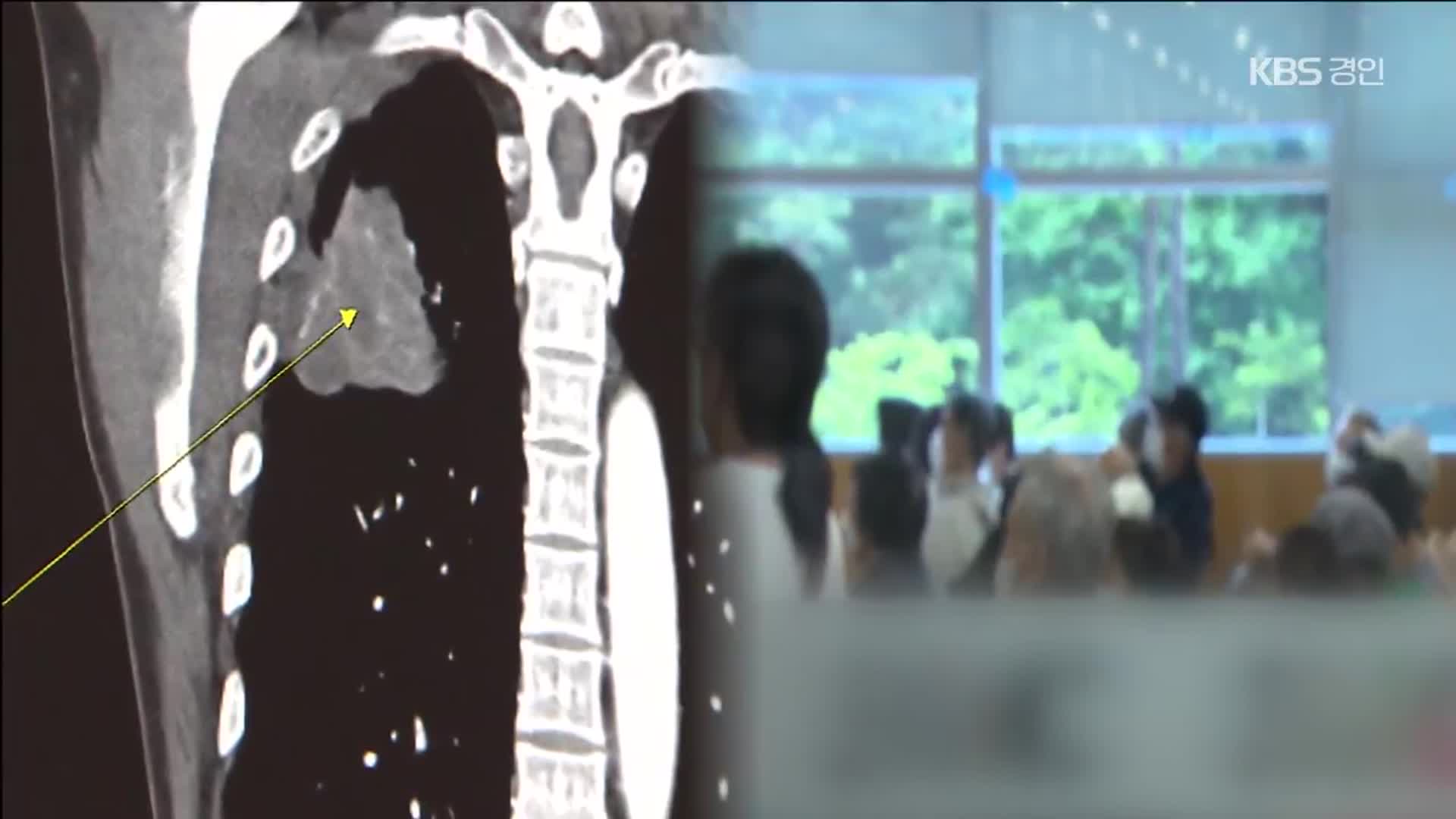 과도한 ‘병원 순례’, 폐암 환자 사망 위험 높인다