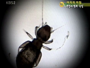 [여자의 아침]신축 아파트에 벌레가 ‘득실’ 