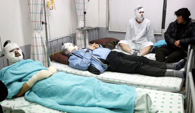 정월대보름인 9일 오후 경남 창녕군 화왕산 정상에서 열린 억새태우기 행사에서 사고로 화상을 당한 등산객들이 얼굴 등에 붕대를 감고 치료를 받고 있다. 