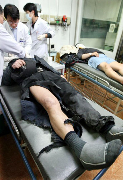 정월대보름인 9일 오후 경남 창녕군 화왕산 정상에서 열린 억새태우기 행사에서 사고로 화상을 당한 등산객들이 병원 응급실에서 치료를 받고 있다. 